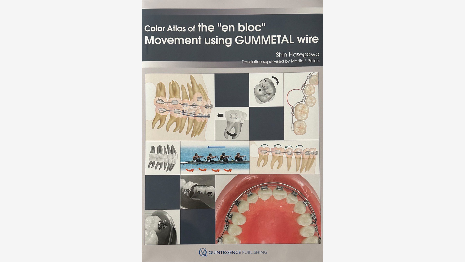 Book: "Color Atlas of the "en bloc" Movement using GUMMETAL wire" by Shin Hasegawa